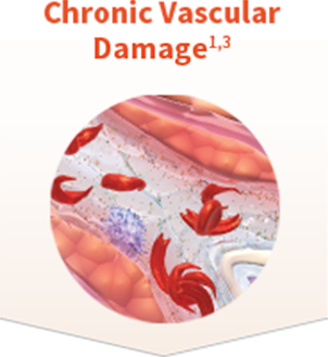 Chronic vascular damage and HbS polymerisation